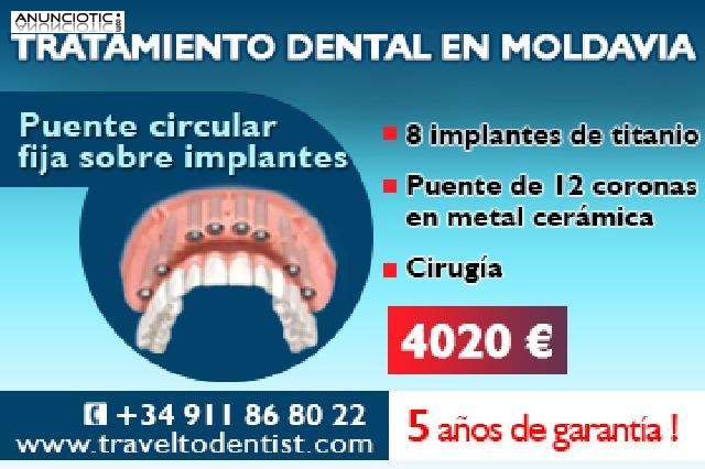 Prtesis fija sobre implantes a un precio increble!