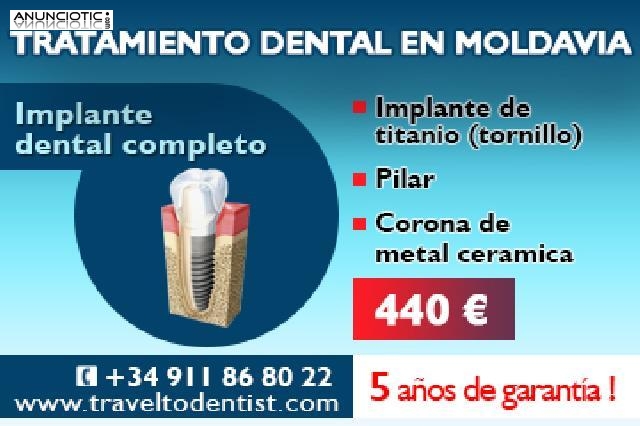 Tratamiento dental en Moldavia