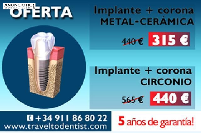 La mejor oferta para los implantes sólo en nuestra clínica de Moldavia