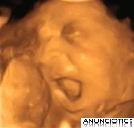 ecografias 4d, centro de imagen 4d prenatal ecomama 4d