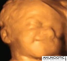 ecografias 4d, centro de imagen 4d prenatal ecomama 4d