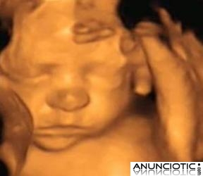 ecografias 4d, centro de imagen 4d prenatal ecomama 4d