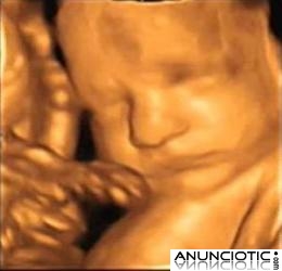 ecografias 4d, centro de imagen 4d prenatal ecomama 4d